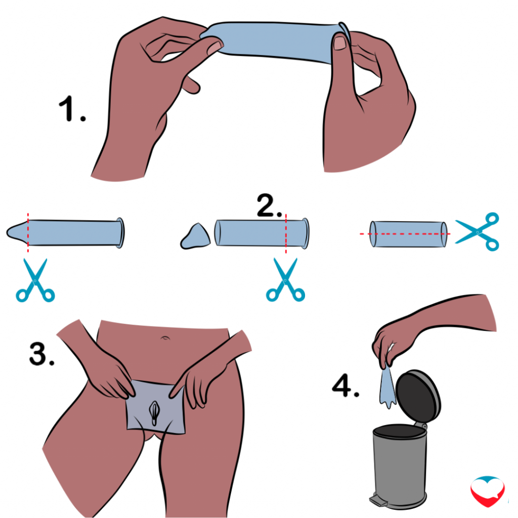 illustration showing how to make a dental dam using a condom