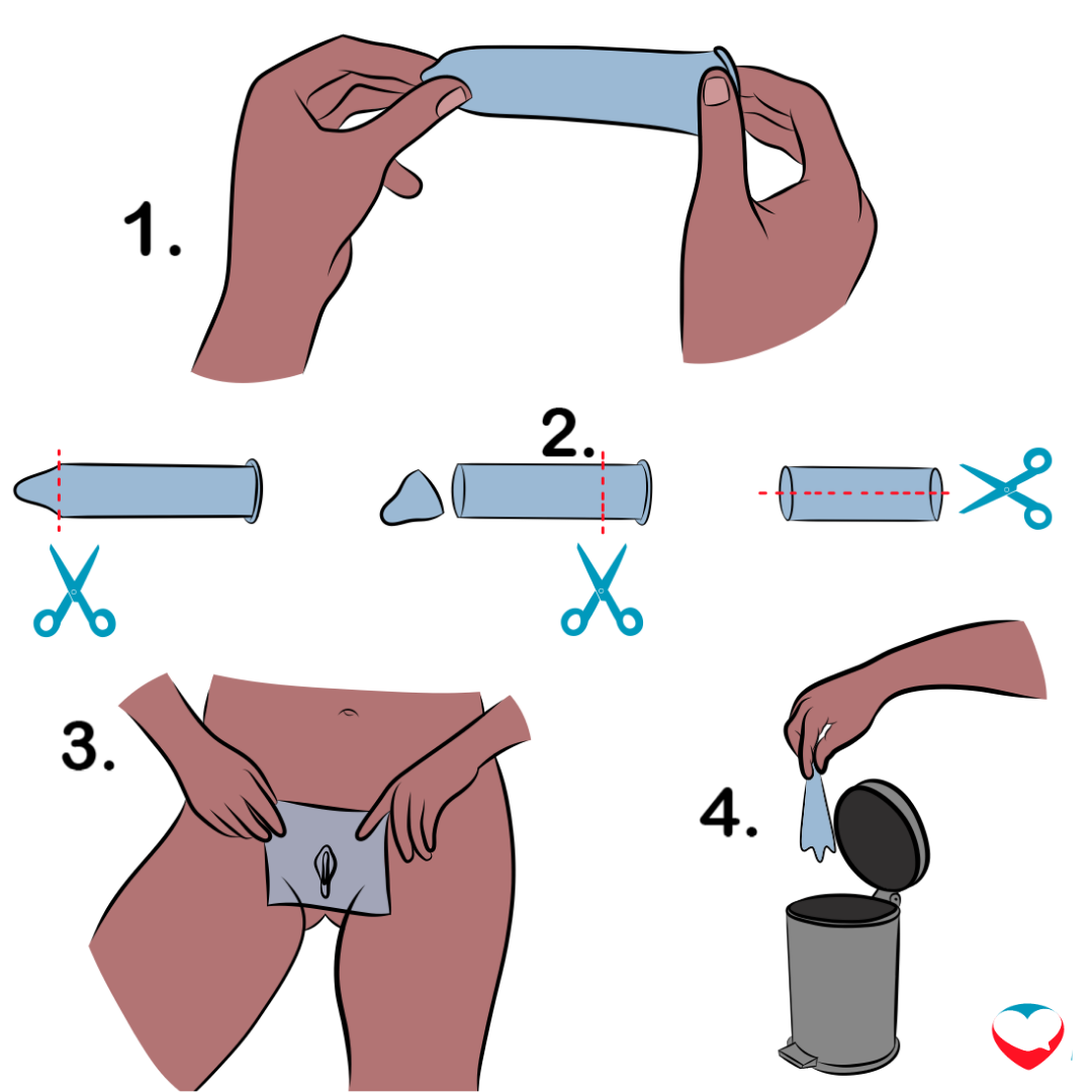 Illustration showing how to use a dental dam