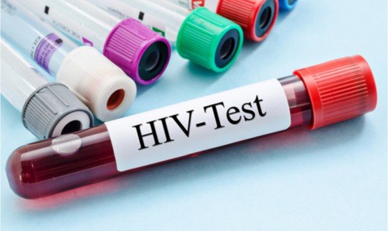 Blood vile with the words 'HIV-test' written on the label 