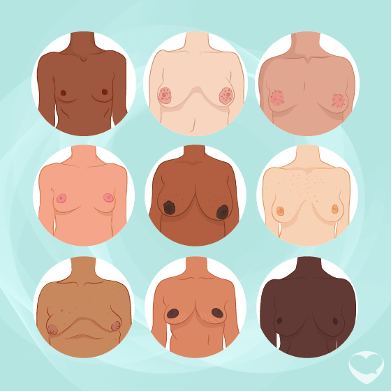 breasts varieties types
