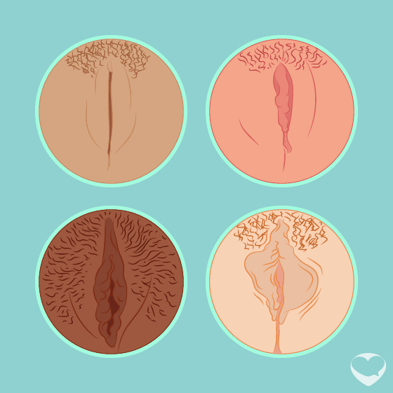 Labia Types