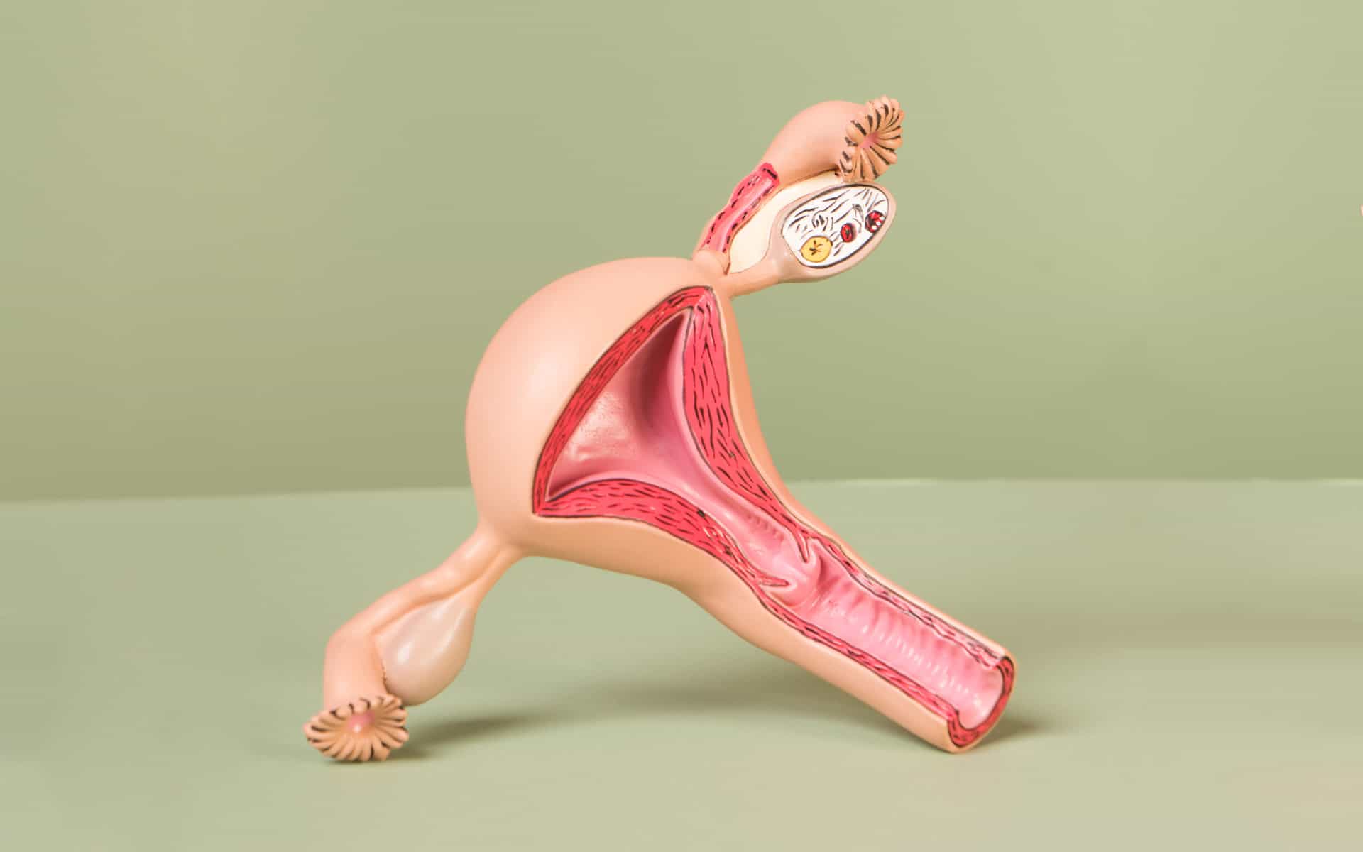 Model of a uterus