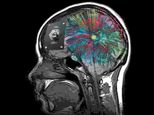 MRI brain with the OFC switched off for an orgasm