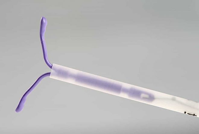 Can IUD be used as emergency contraception?
