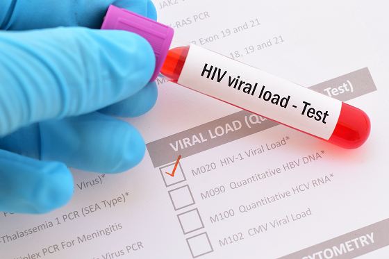 tube with inscription 'HIV viral load -Test'