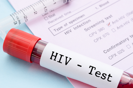 HIV test kit