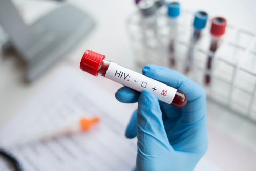 hand in blue medical glove holding a HIV test